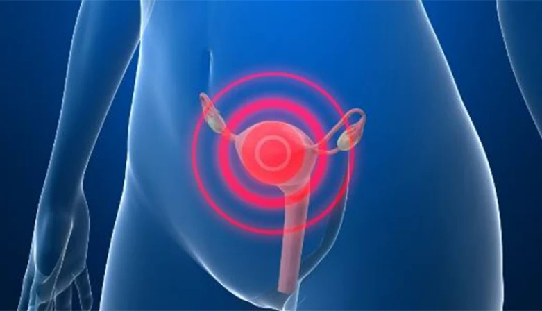 Existem três tipos de cirurgias de histerectomia possíveis de serem realizadas