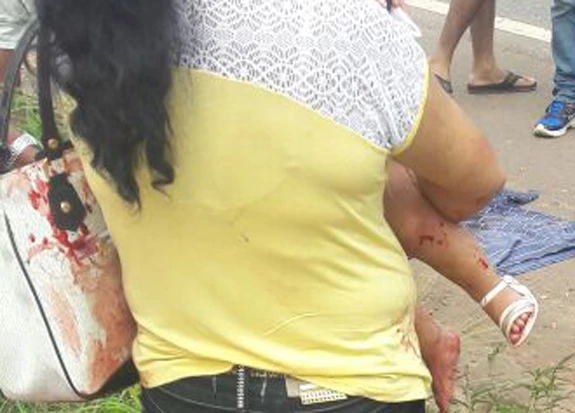 Uma criança está entre as vítimas. / Foto: Divulgação