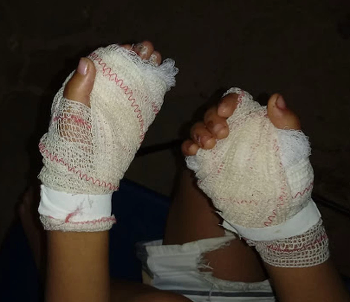 Menino de quatro anos teve as mãos queimadas pela própria mãe. (Foto: Divulgação)