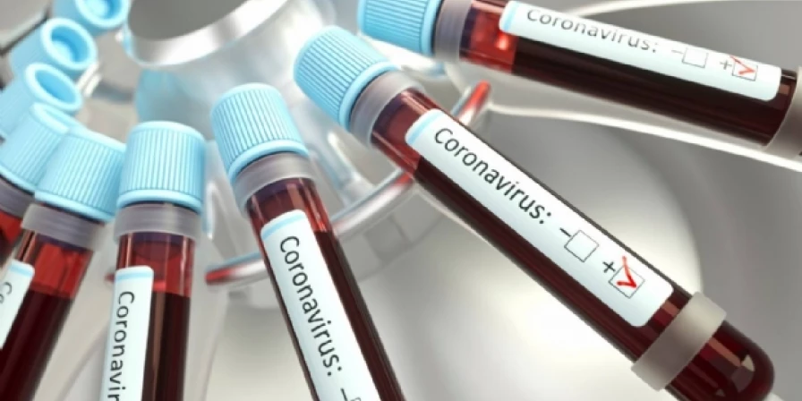 Ministério da Saúde divulgou dados atualizados sobre a pandemia do novo coronavírus no Brasil.