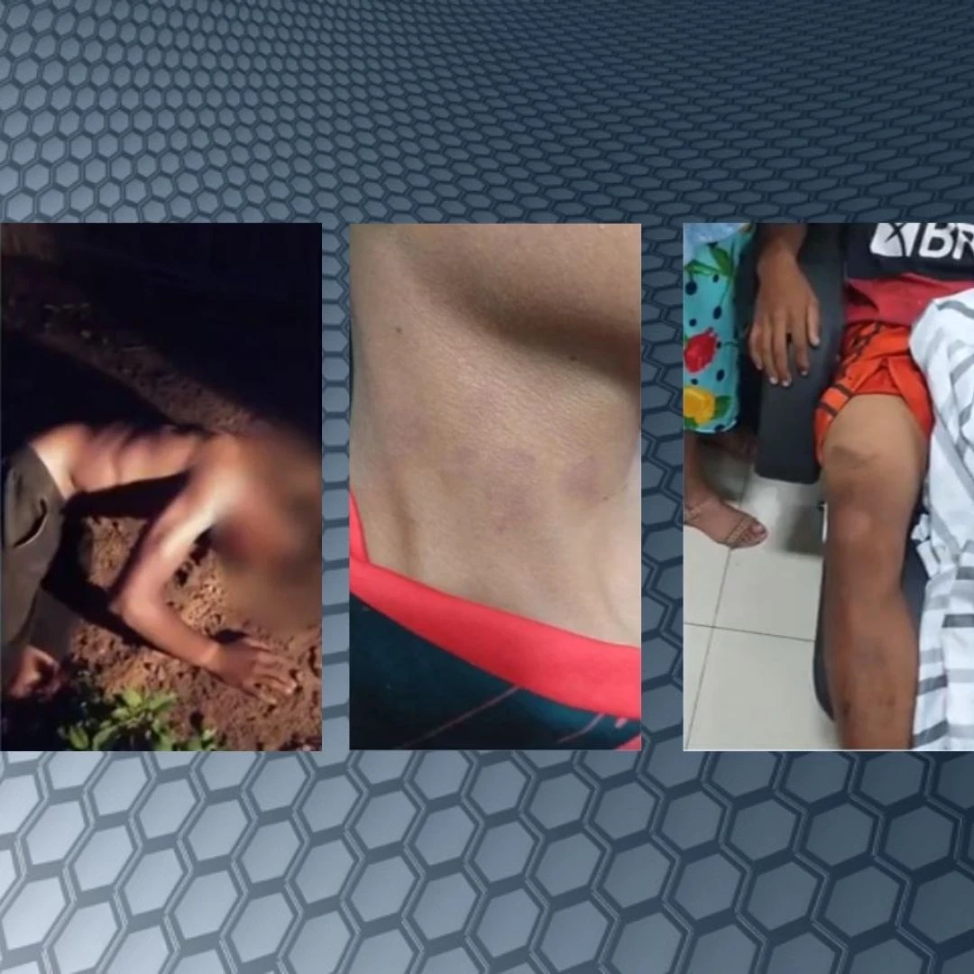 Adolescente foi espancado com chutes e socos na cabeça. Foto: Reprodução.