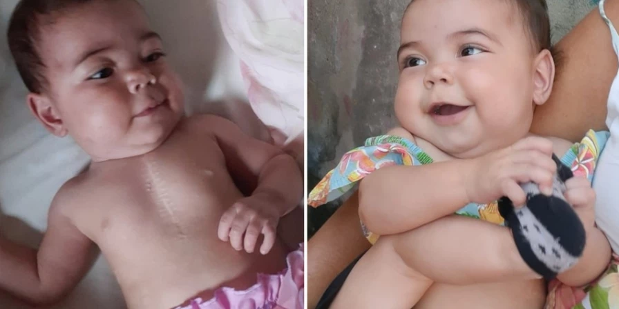 A pequena Isadora foi diagnosticada ainda no ventre com cardiopatia congênita (hipoplasia do coração esquerdo).