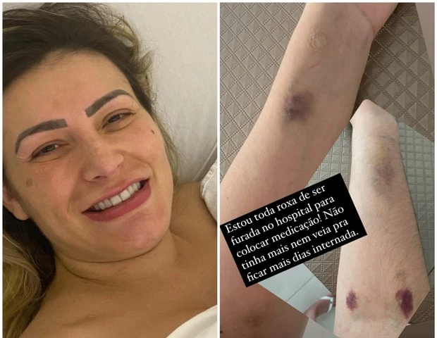 Andressa, por conta do parto prematuro, ficou em observação na unidade médica e realizou muitos exames para verificar inchaços nos pés.