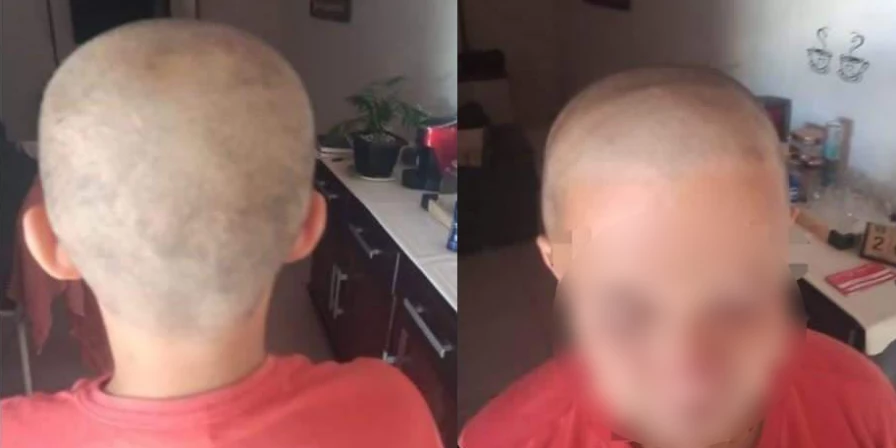 Jovem tem a cabeça raspada por coordenador em Vitorino Feire.