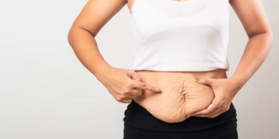 Exercícios físicos mal feitos podem causar diástase