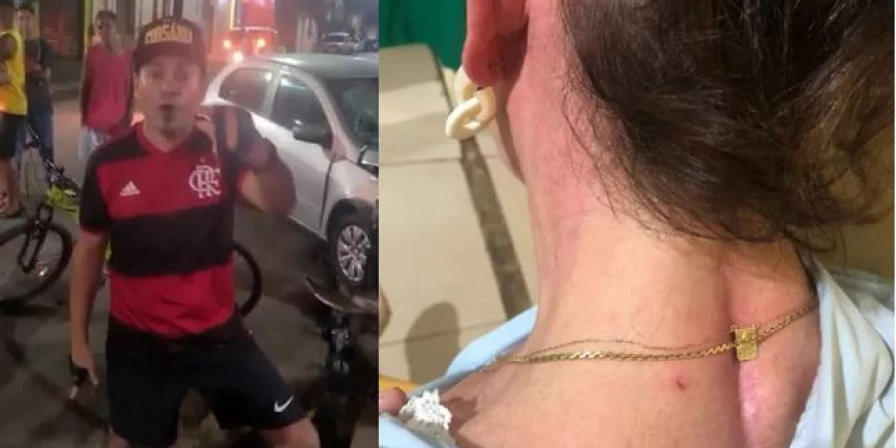 Advogada foi agredida por policial civil em Pinheiro.