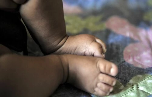Em 2022, o SUS registrou 2.754 internações de bebês menores de um ano por desnutrição. (Foto: Marcello Casal Jr/Agência Brasil)