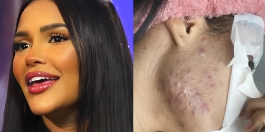 Ex-BBB Flay mostra reação ao chip da beleza.