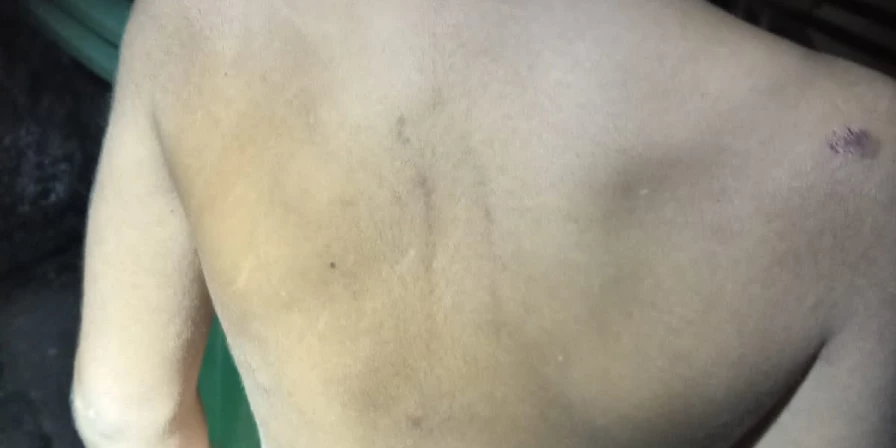 O menino está internado no hospital.