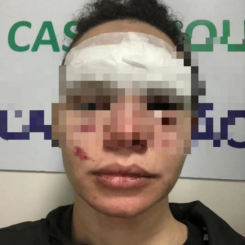 Ela chegou a levar pontos no supercílio por causa das agressões. Foto: Divulgação