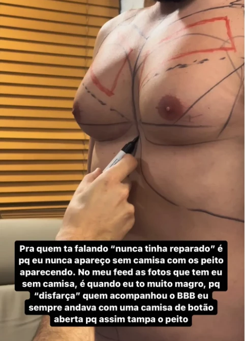 Eliezer explica sua cirurgia. (Foto: Reprodução / instagram)