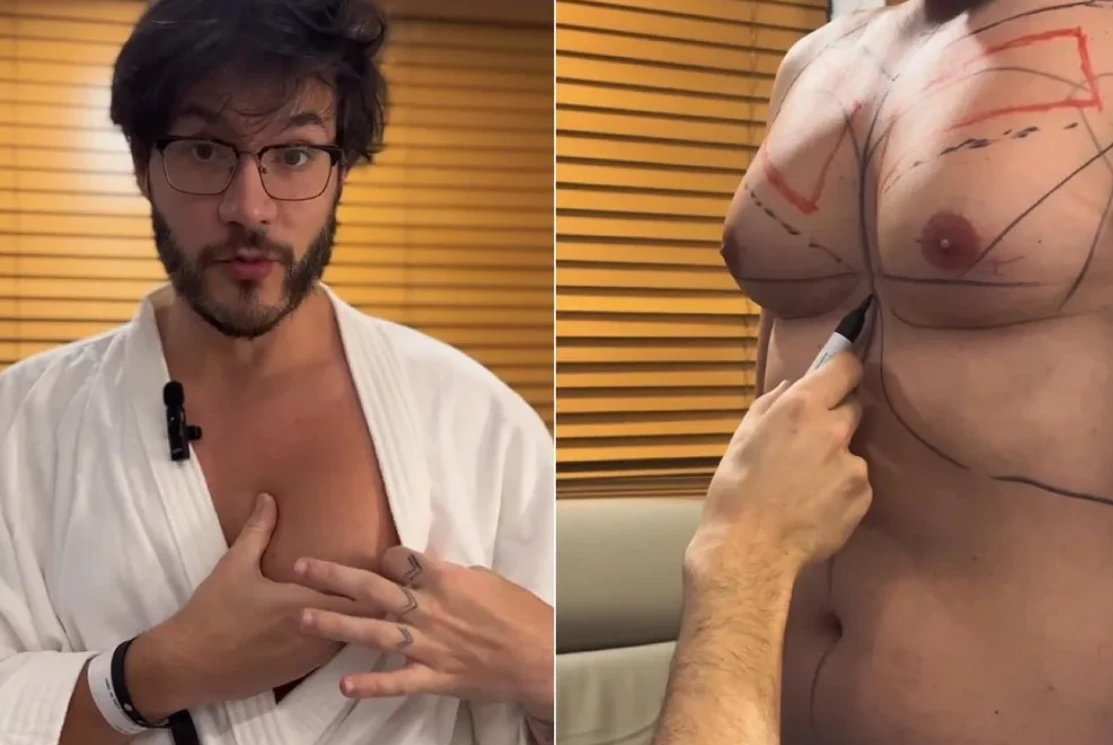 Eliezer passa por cirurgia de ginecomastia com lipoaspiração. (Foto: Reprodução / Instagram)