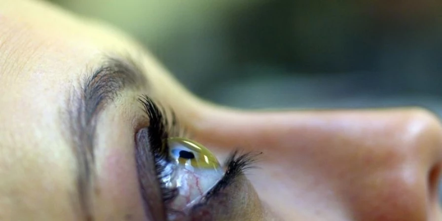 O glaucoma ainda é desconhecido por grande parte da população brasileira.