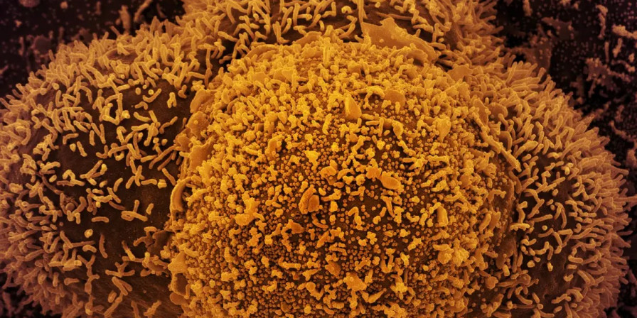 Covid-19 mata 29 no Brasil