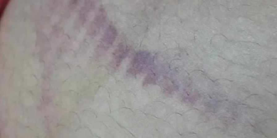 A vítima levou um chute na ba