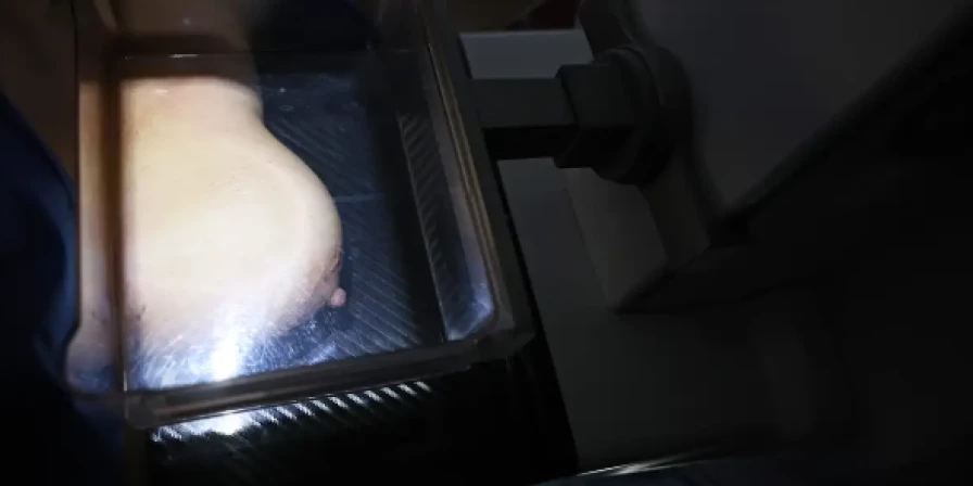 De acordo com o CBR, a mamografia figura atualmente como um dos exames mais eficazes para detecção do câncer de mama em fase inicial.