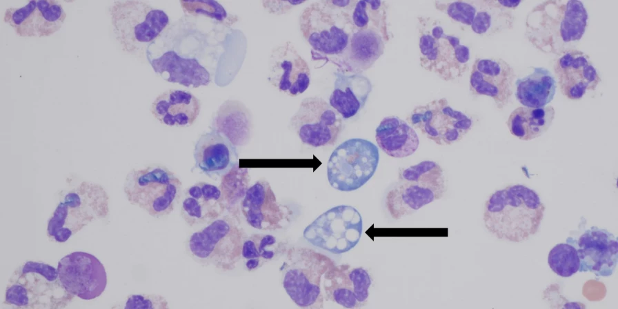 A ameba Naegleria fowleri, conhecida como "ameba comedora de cérebro".