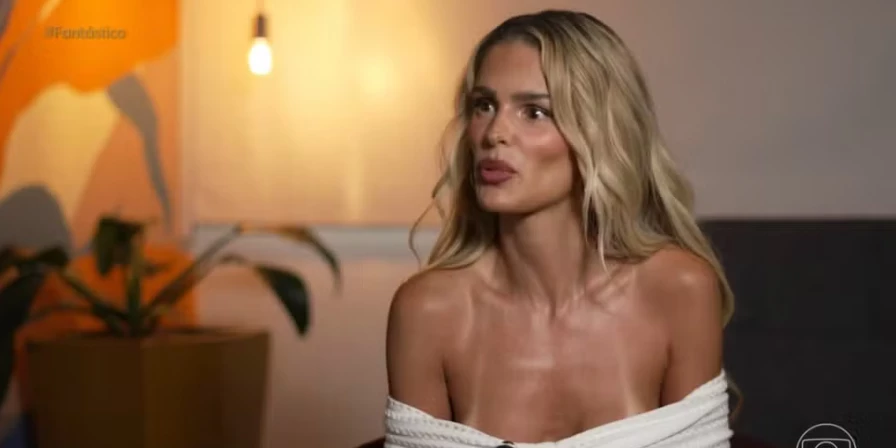 Yasmin Brunet fala sobre diagnóstico de lipedema durante o Fantástico.