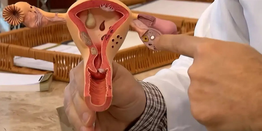 Março Lilás: Combate ao Câncer de Colo Uterino