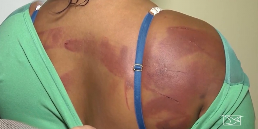 Violência contra mulher