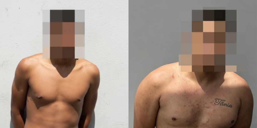 Dupla suspeita de três assassinatos é presa em operação policial em Imperatriz
