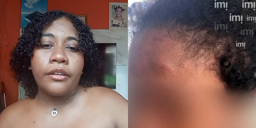 Doméstica perde 50% da audição após agressão