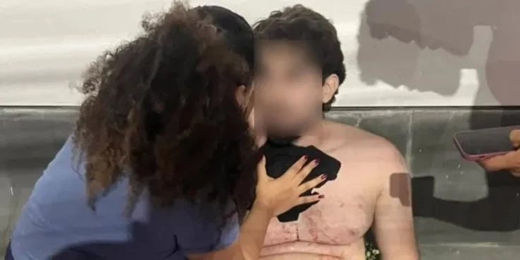 Jovem baleado após sair de academia segue em estado grave na UTI em São Luís. Jovem baleado após sair de academia segue em estado grave na UTI em São Luís. (Foto: Reprodução)